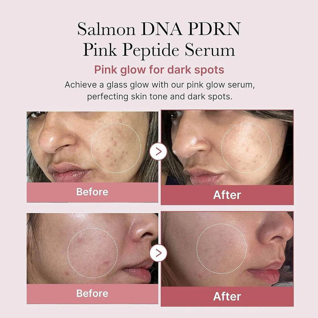 Medicube Salmon DNA Peptide Serum